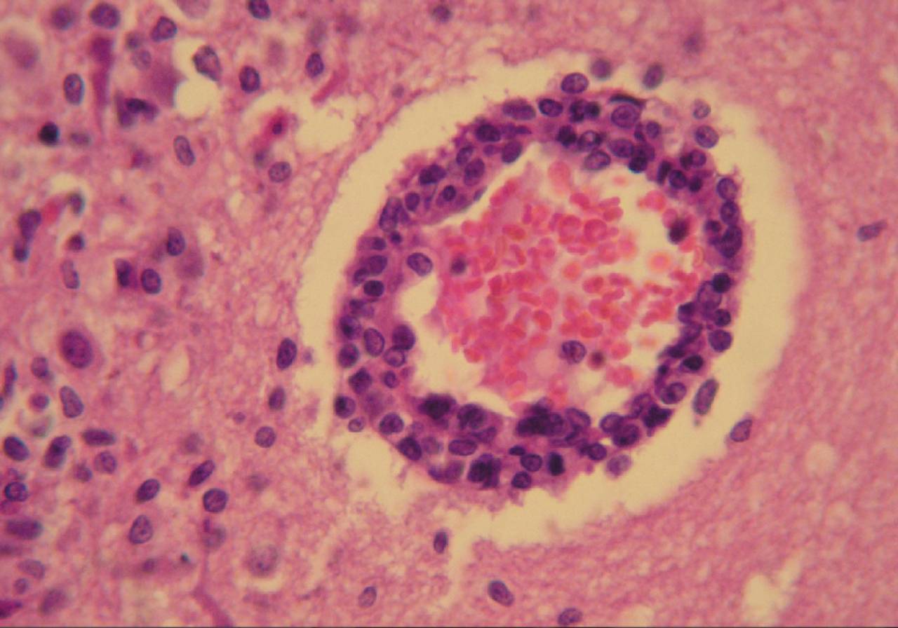 imagem da doença herpesvírus bovino