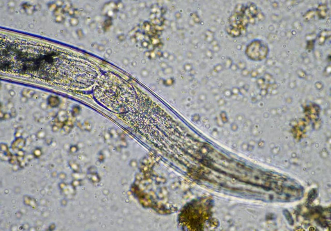 imagem em microscópio de verme